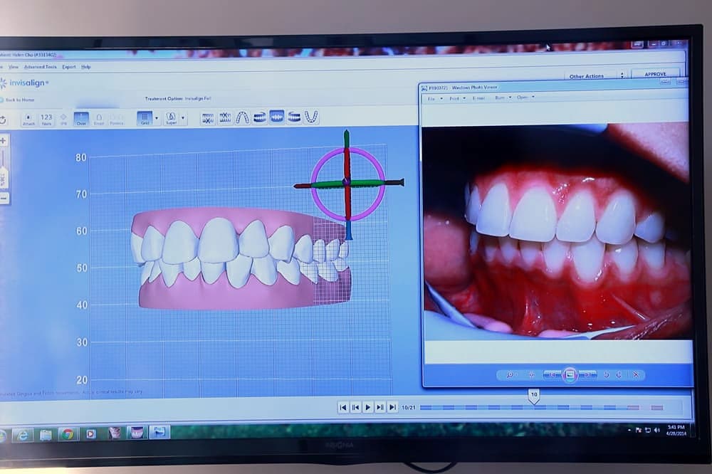 Inside Hillside Dentistry & Orthodontics — Torrance, CA